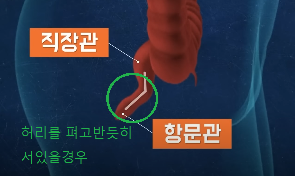 급똥참는방법4