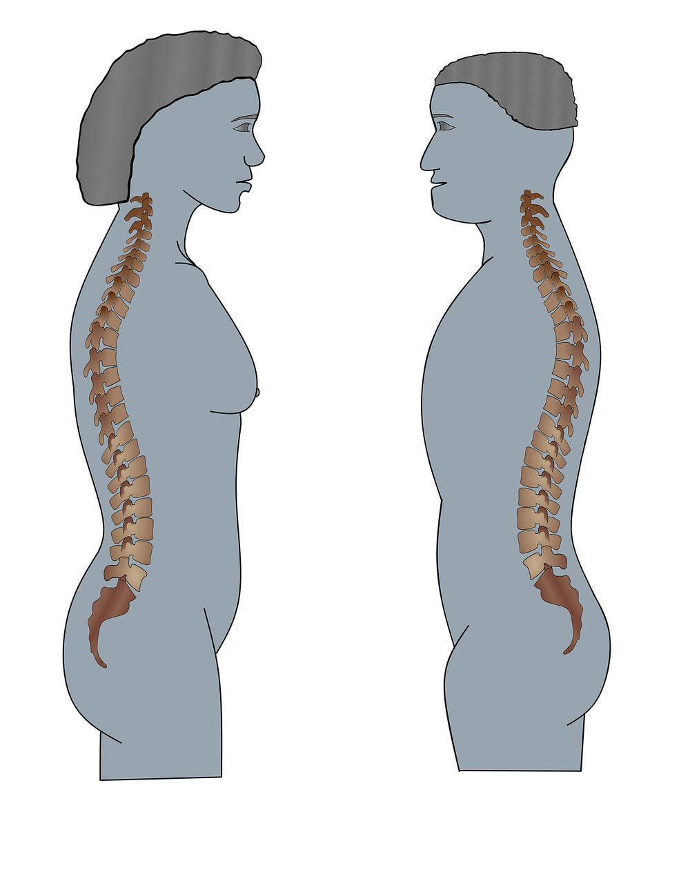 고관절 통증 원인&amp;#44; 충돌증후군&middot;근육 손상부터 관절염까지