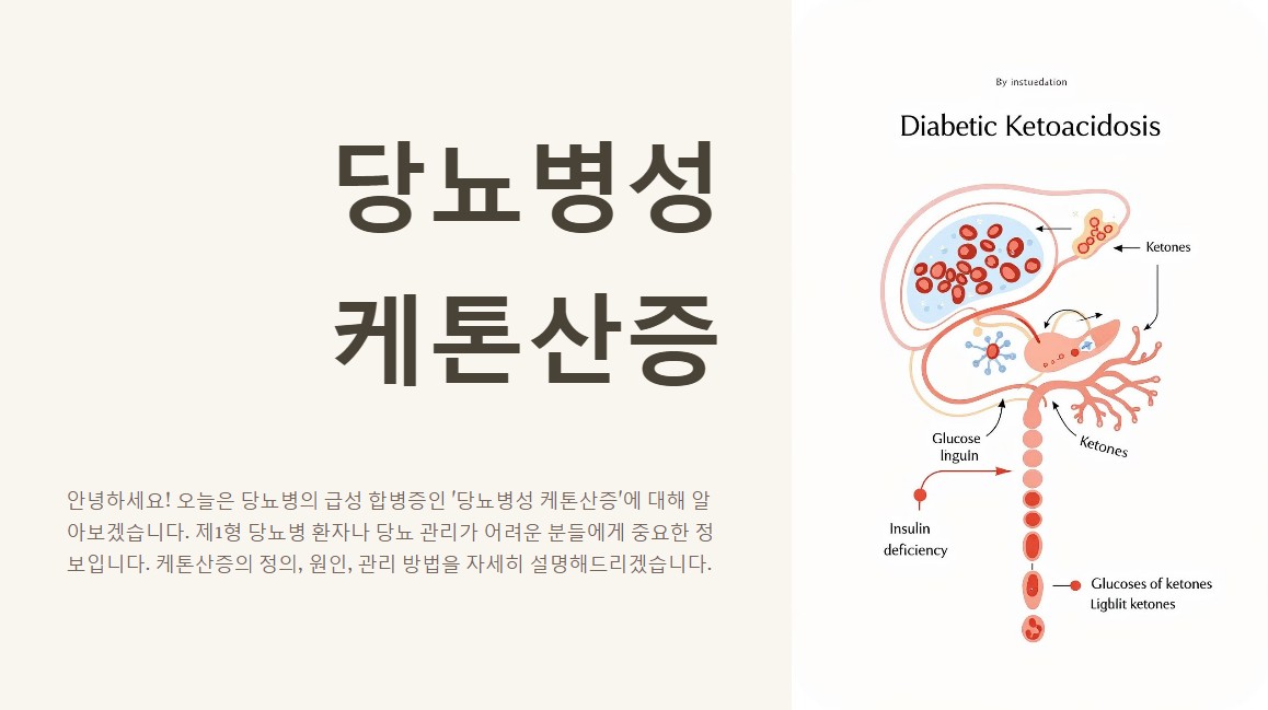 당뇨병성 케톤산증 원인과 증상 관리방법