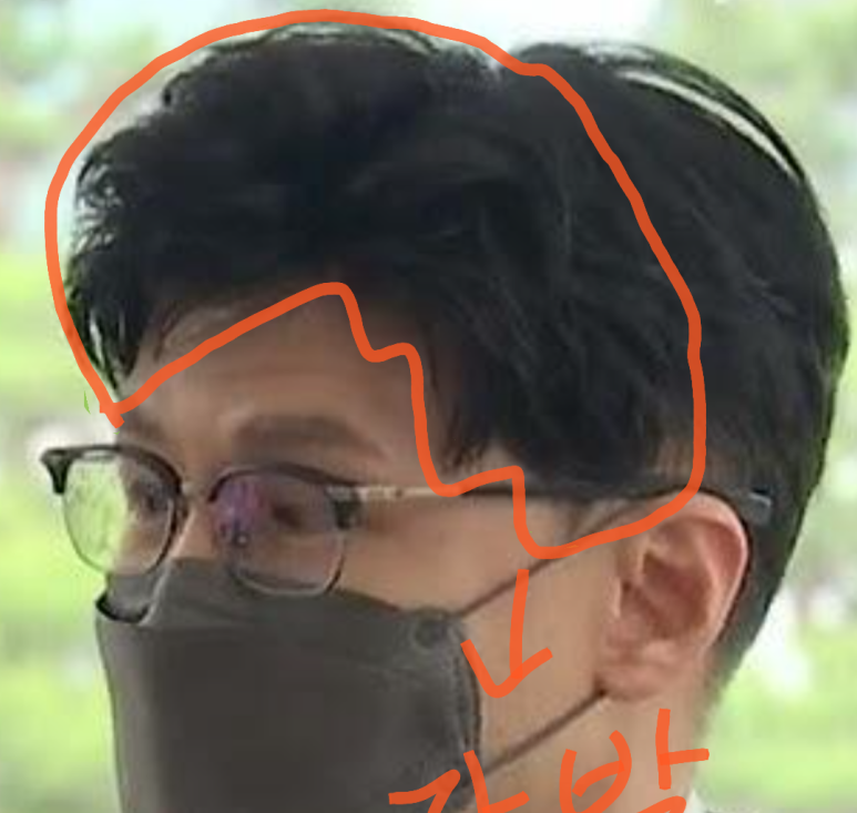 한동훈 대머리