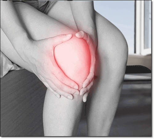 무릎 관절염 환자