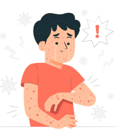 대상포진 초기증상, 주요증상, 초기 대응방법