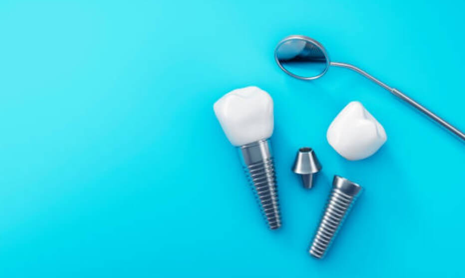 임플란트 잇몸뼈