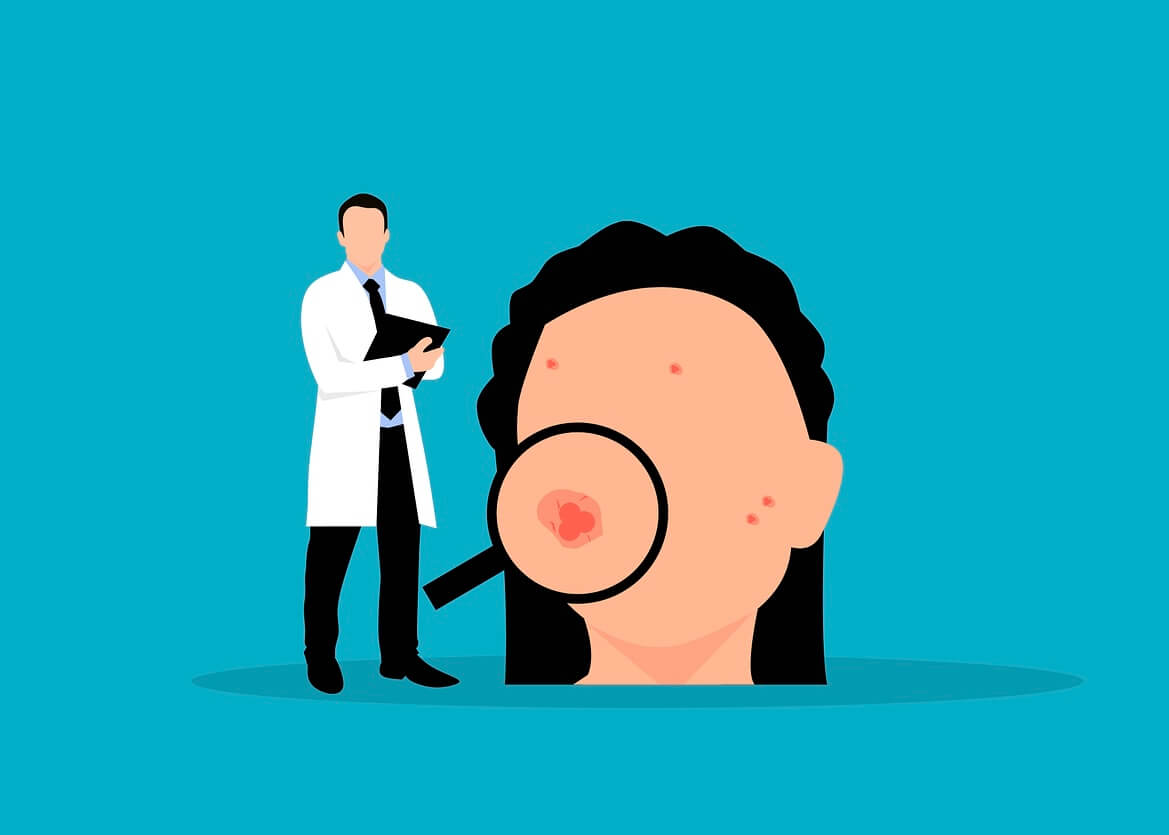 피부과 여드름 치료