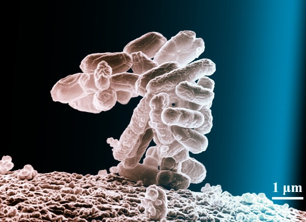 서로-뭉쳐있는-미생물