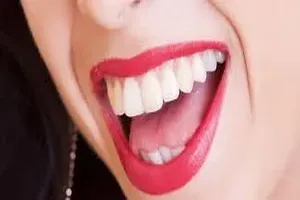 치아