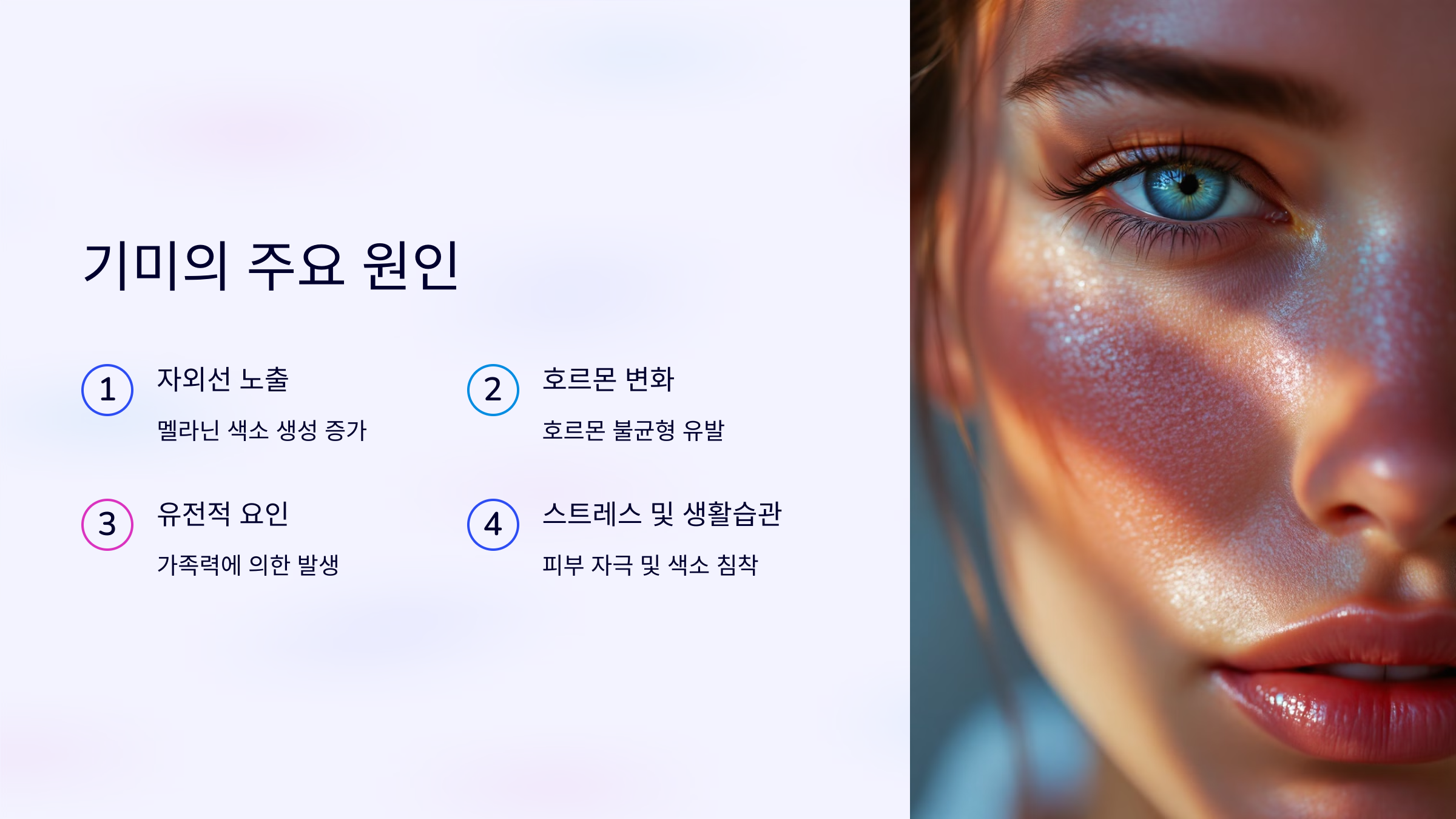 기미치료 기미의 주요원인