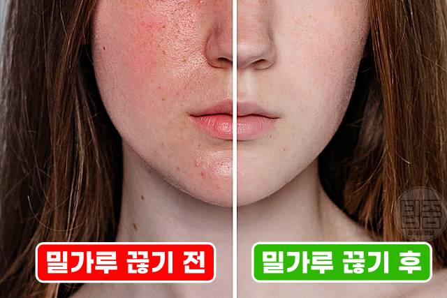 밀가루 끊기 효과 밀가루끊기 한달 피부 여드름