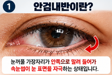 안검내반 증상