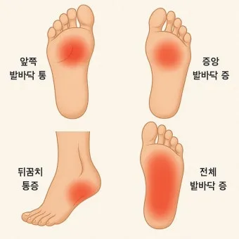 발바닥통증의 원인들과 해결책_23