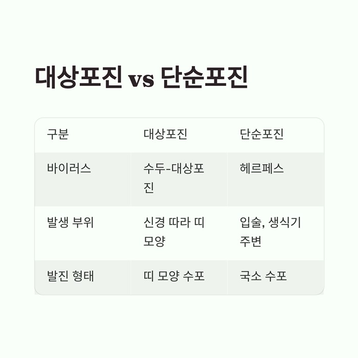 대상포진 초기증상 5가지&amp;#44; 단순 두드러기와 다른 점 요약 이미지