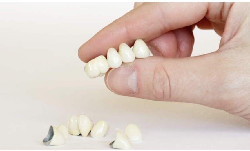 빠진 이빨의 모습