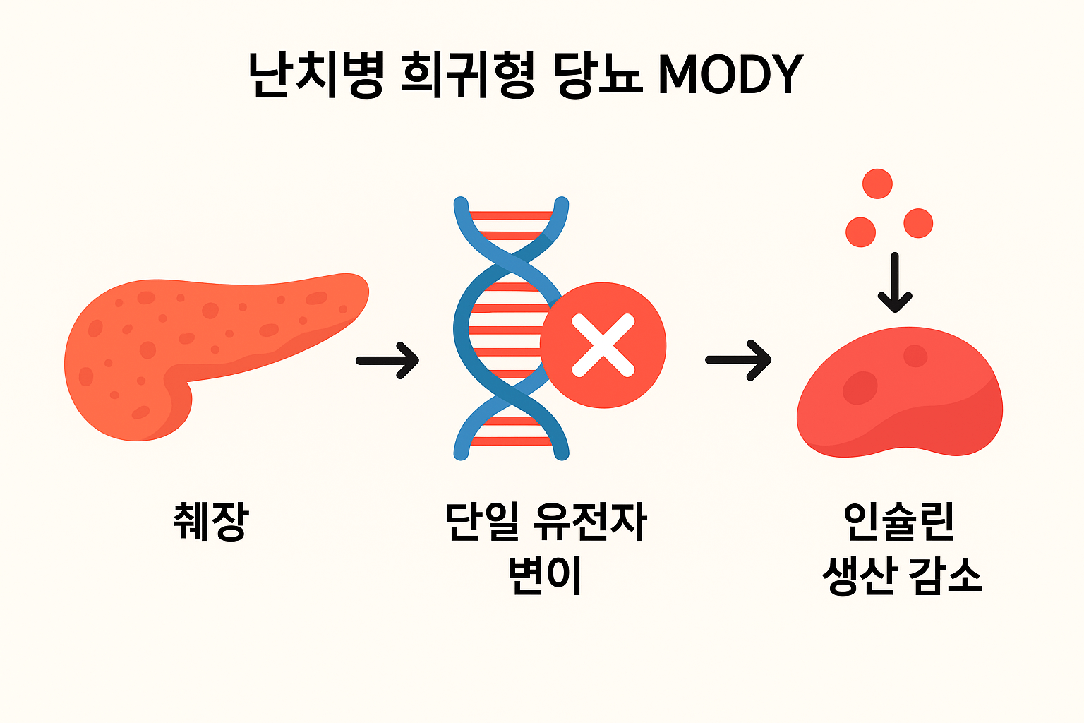 희귀형 당뇨 MODY