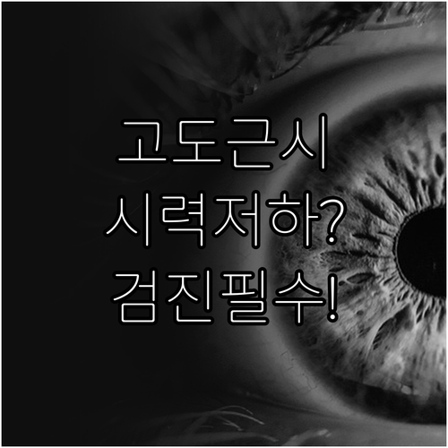 고도근시 시력교정술 후 시력 변화 이..