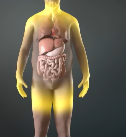 중성지방 정상수치