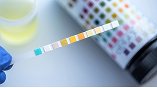 소변 색깔이 노란색