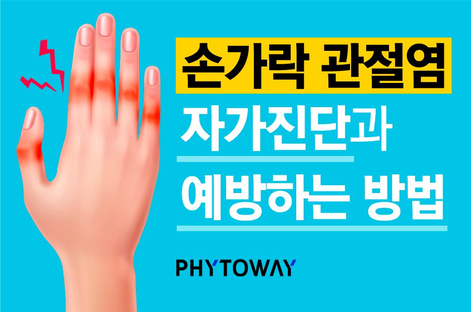 손가락 관절염