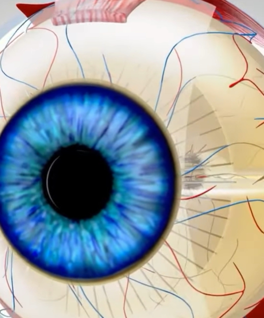 녹내장 초기증상