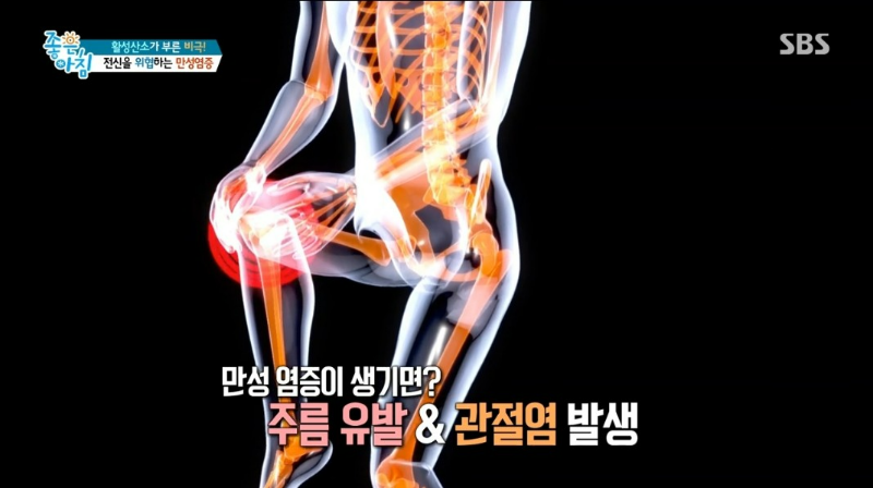 만성 염증 과 질환