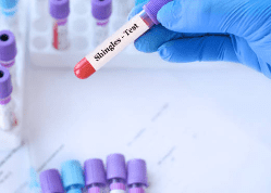 대상포진 예방접종 가격