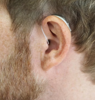 귀에서 삐소리가 나는 이유 이명 원인 대처법