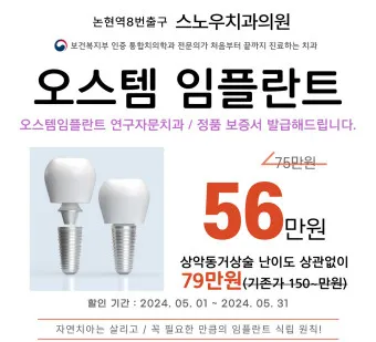 오스템 임플란트 수명 시술기간_23