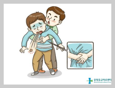 기도폐쇄-시-응급처치방법-하임리히법