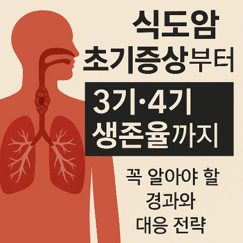 식도암 초기증상부터 식도암 3기, 식도암 4기 생존율에 대한 이미지 썸네일