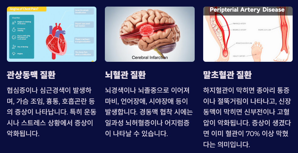 죽상경화 증상