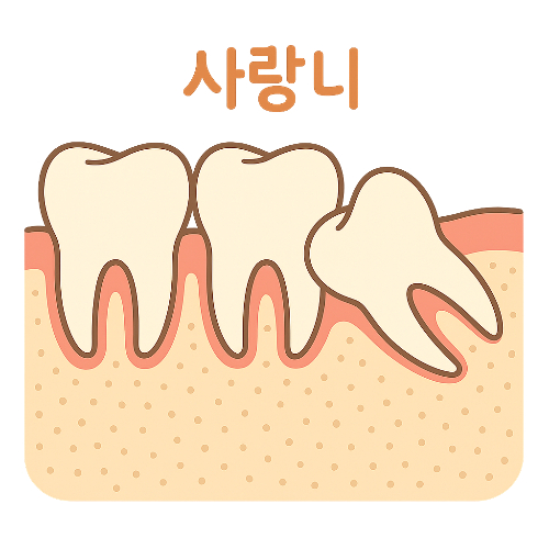 사랑니-발치후-입냄새-없애는법