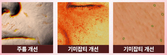 고혼진 4주 개선 효과