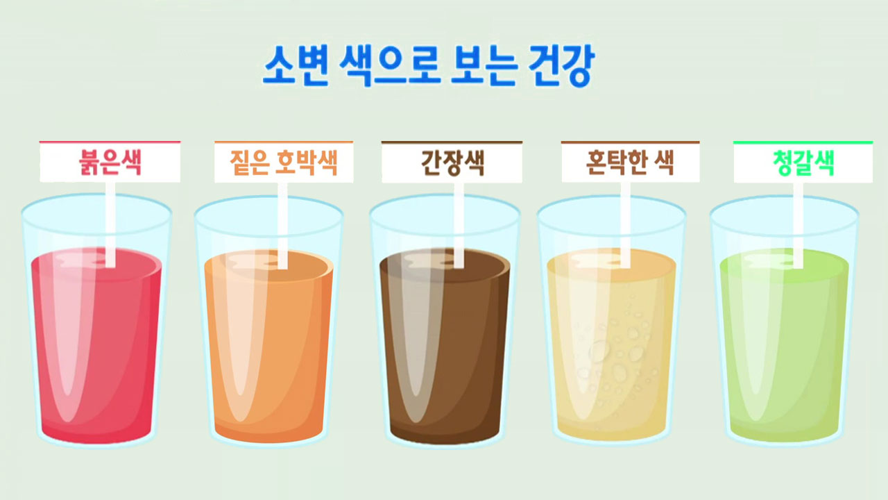 소변 색으로 보는 건강
