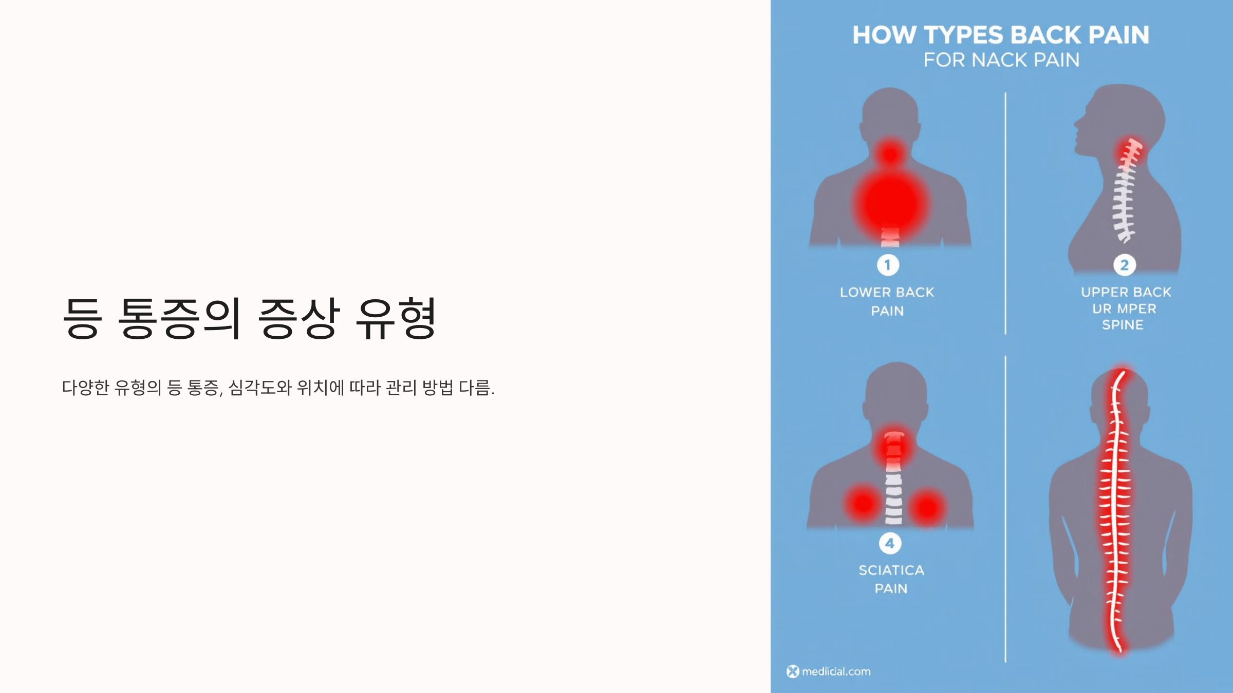 등이 아픈 증세와 관련된 사진입니다.