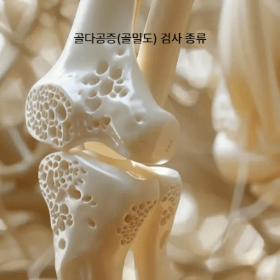 골다공증 검사 비용 & 보험 적용 총정리 (2025 최신 가이드)