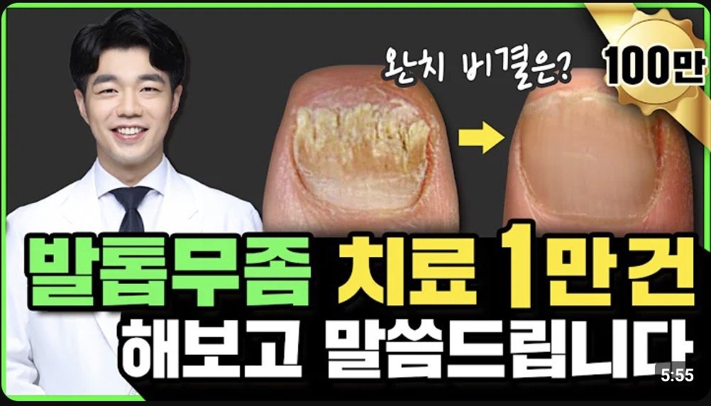 발톱 무좀 약 없애는 방법
