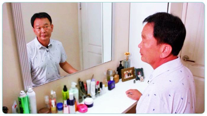 명의-남성-탈모