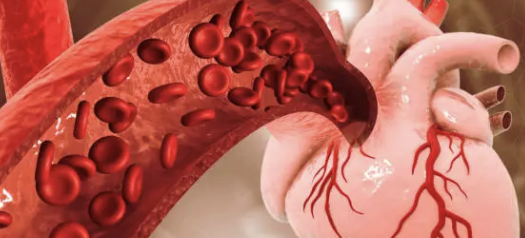 고지혈증 약의 부작용 34