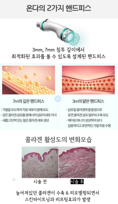 온다리프팅6만줄가격 통증 효과 부작용 이중턱 심부볼 타이트닝 전후 차이 세밀하게 비교 분석하기