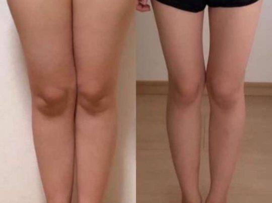 레그필 후기, 내돈내산