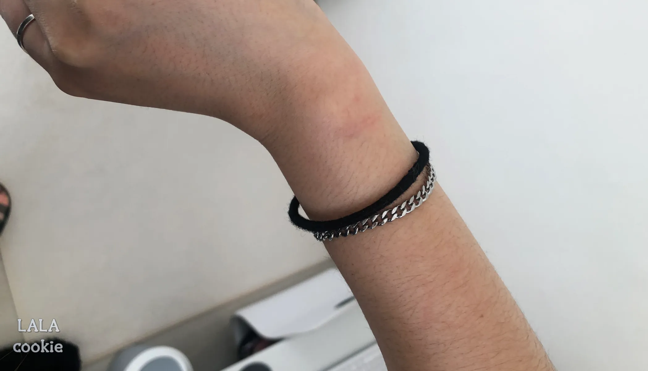 고양이-처음-키울때-힘든점-깨물린-사람-팔