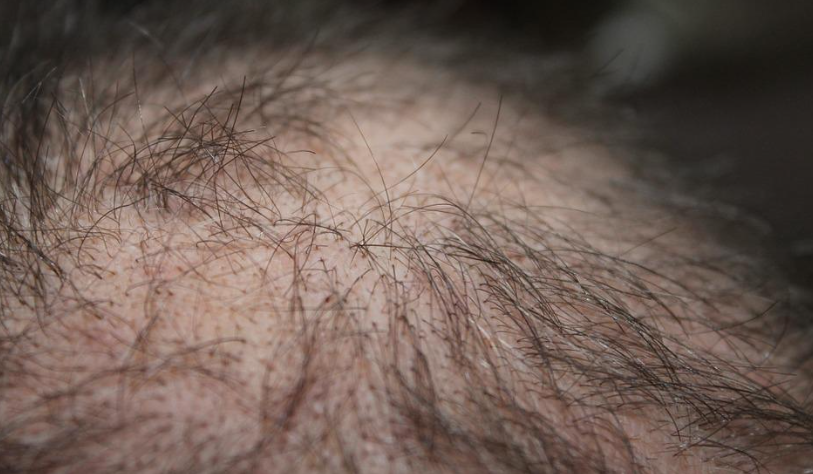 ๋จ์ฑํ ํ๋ชจ์๋ฐฉ์๋ ๋์์ด ๋๋ ์ํ๋ฉํ