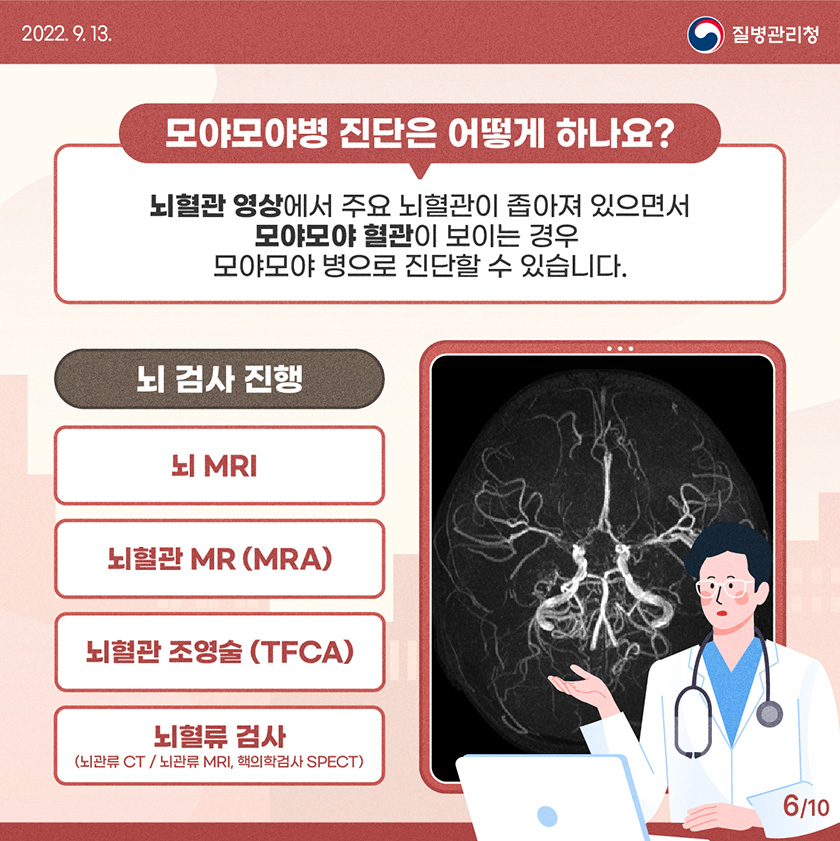 모야모야병 유전 증상 원인 치료 수술