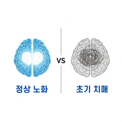 치매 초기 증상 10가지