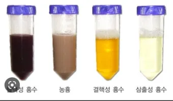 폐에 물이 차는 원인 증상 물참 관리 포인트에 대한 건강정보_11