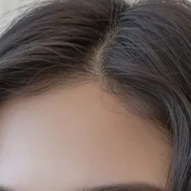 쌍꺼풀 수술 이미지 - 쌍꺼풀 수술을 받은 사람