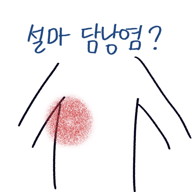 직접 그린 앤디 워홀의 사인 분석과 담낭염 통증 부위 및 예방 수칙 일러스트