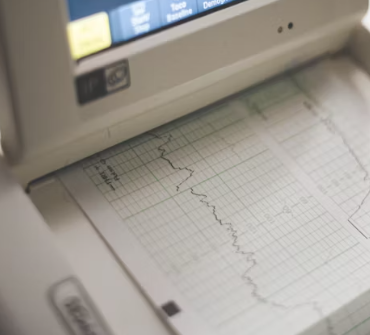 협심증 진단방법 치료법 합병증 예방