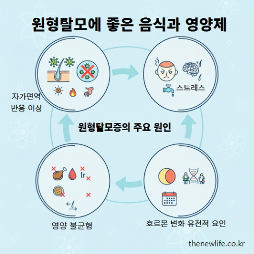 원형탈모증의 주요 원인을 설명하는 인포그래픽 – 자가면역 반응 이상, 스트레스, 영양 불균형, 호르몬 변화 및 유전적 요인을 순환 구조로 보여주는 이미지