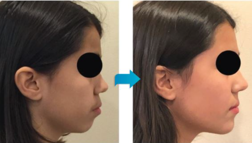 교정하면 안되는 이유