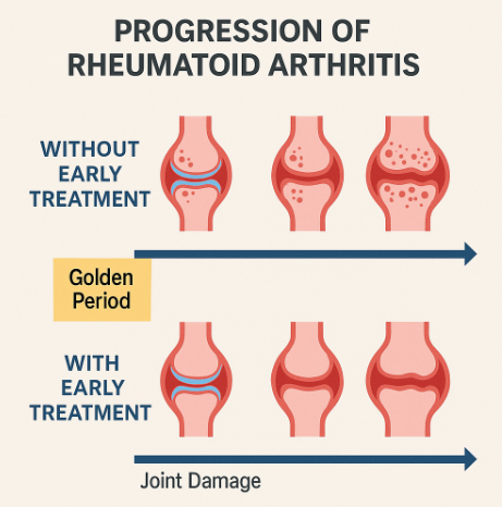 조기 진단의 중요성을 강조하는 타임라인 이미지]